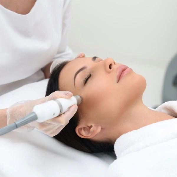 Micro-needling Scottsdale