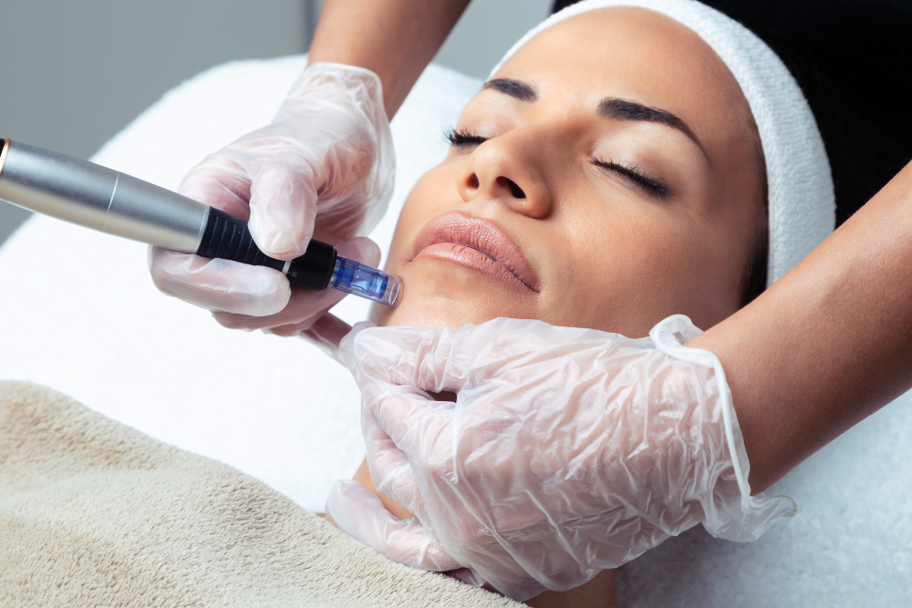 You are currently viewing Microneedling FAQs: Unveiling the Secrets to Glowing Skin