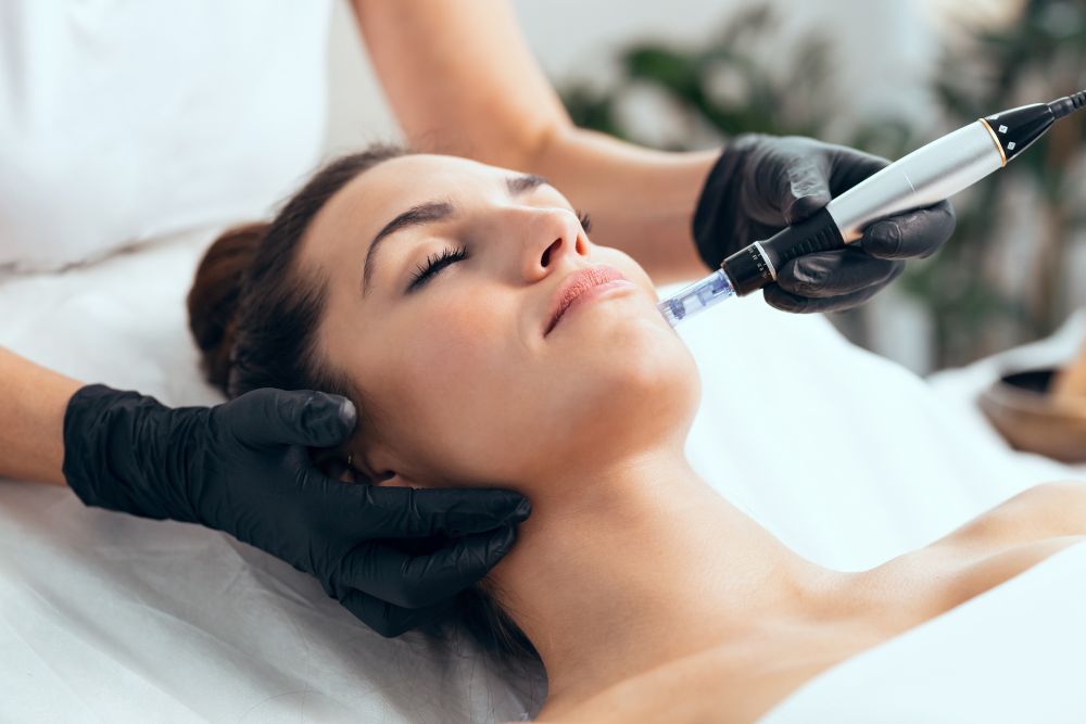 A close-up photo of a person undergoing microneedling treatment, with a relaxed and confident expression.