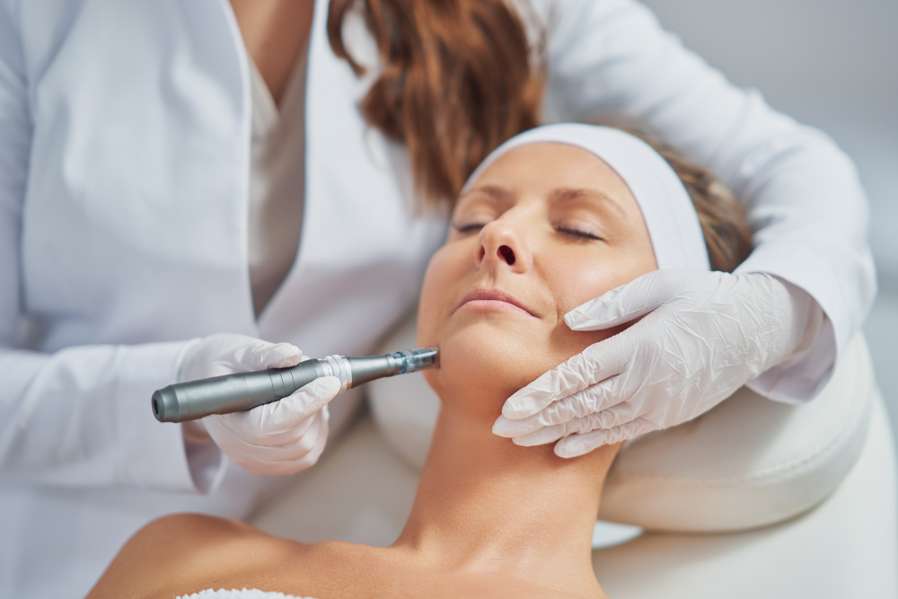 A magnified image of a microneedling device with close-up detail of the tiny needles gently piercing the skin's surface.