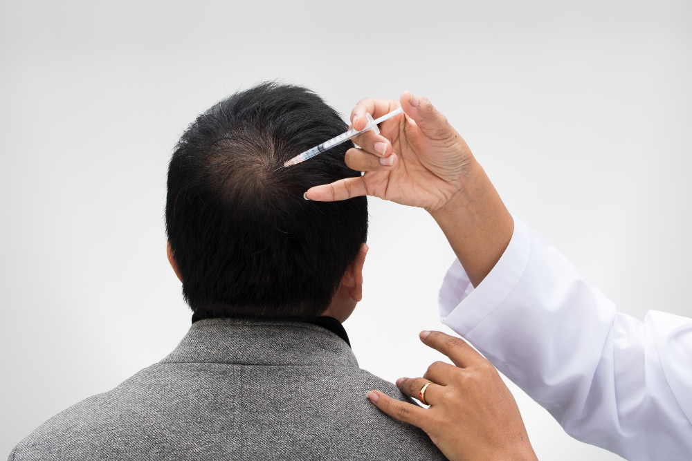 A collage showcasing medication bottles for Minoxidil and Finasteride, a hair transplant procedure, and a low-level laser therapy device being used on a scalp.