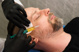 Read more about the article PRP Facelifts for Men: Redefining Masculinity in the Age of Self-Care