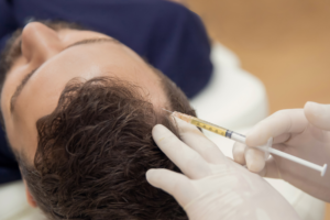 Read more about the article PRF Hair Restoration: Does Gender Matter?