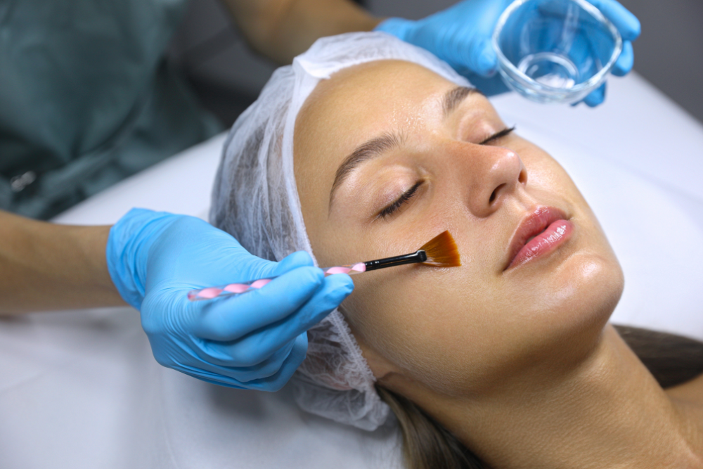 You are currently viewing Chemical Peels Demystified: Unveiling the Truth Behind Medical-Grade Treatments