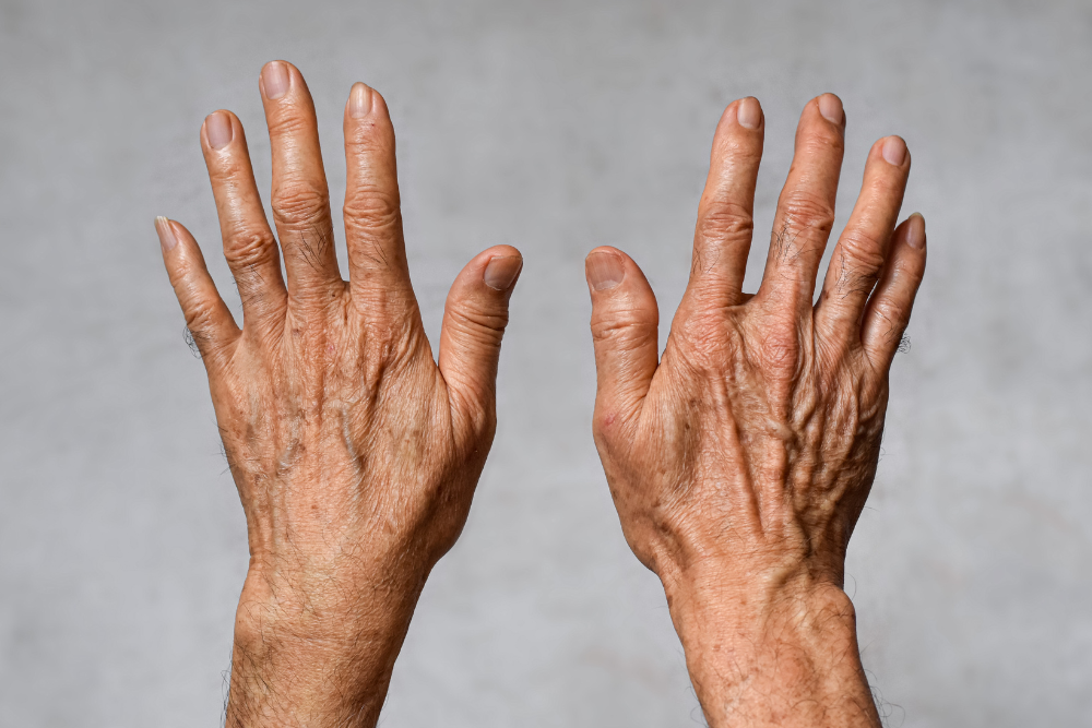 A split-screen image. On one side, a close-up photo of an arm with visible sun spots. The other side showcases a close-up photo of an arm with visible age spots.