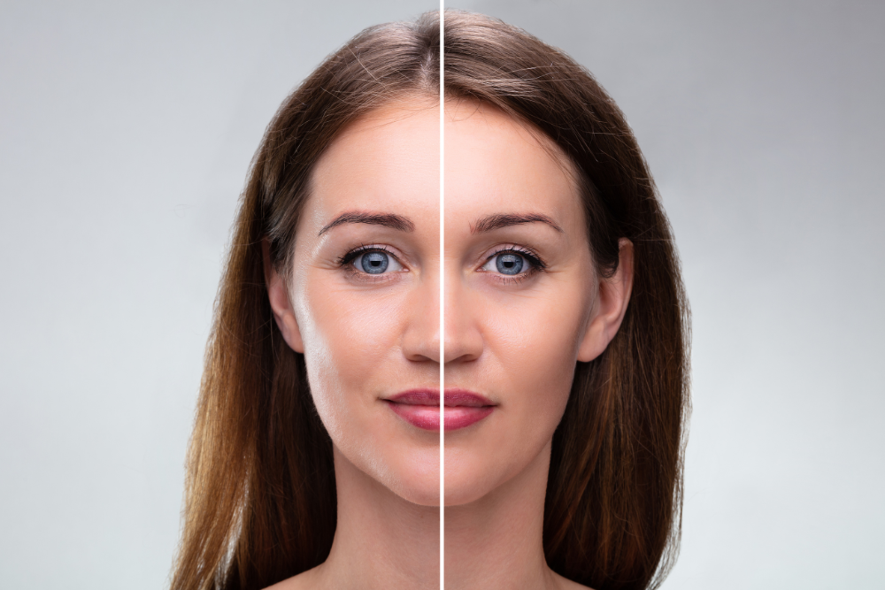 A split-screen image. On one side, a close-up photo of dull, uneven skin with wrinkles and fine lines. On the other side, a close-up of healthy, glowing skin with a youthful appearance.