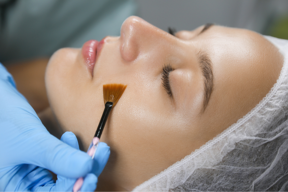 A collage showcasing the different depths of medical-grade peels (superficial, medium, deep), topical anaesthetic cream being applied, post-peel care steps like gentle cleansing, moisturizing, and sunscreen application, and someone avoiding picking or scratching their skin.