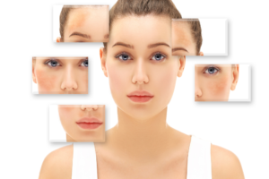 Read more about the article Daily Skincare Habits to Prevent Dark Spots (PIH)