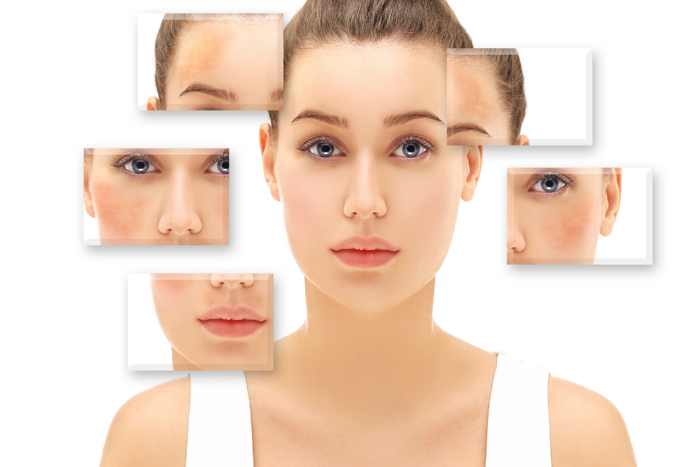 You are currently viewing Daily Skincare Habits to Prevent Dark Spots (PIH)