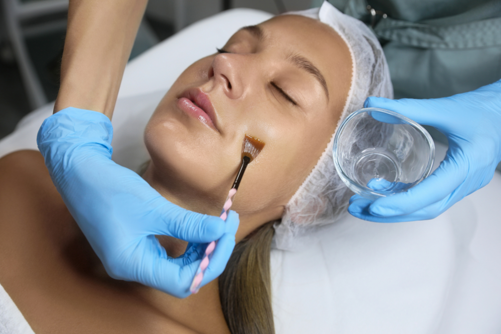 You are currently viewing Chemical Peels: Debunking Myths and Unveiling Benefits