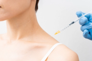 Read more about the article Long-Term Results After Trapezius Botox: Maintaining a Pain-Free Neck and Shoulders