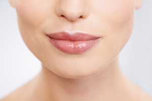 Read more about the article Beyond Lip Augmentation: Exploring Other Uses for Restylane Kysse