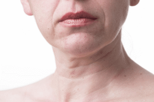 Read more about the article The Lines of Time: Understanding Why Chin Wrinkles Form