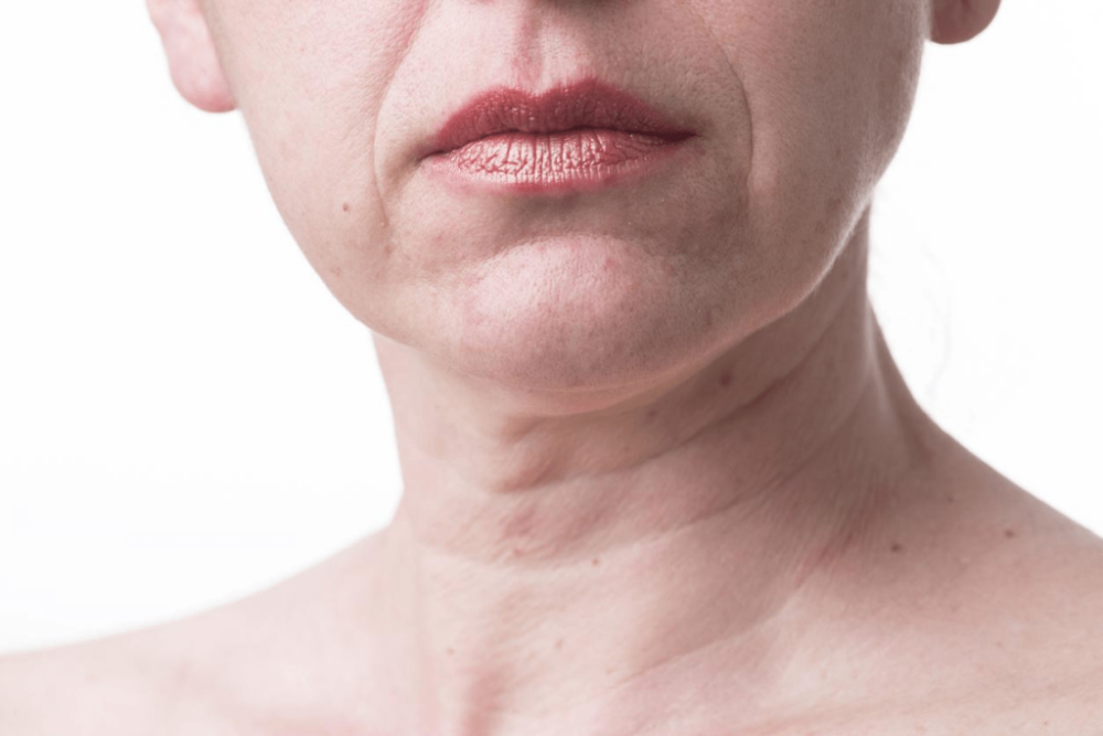 You are currently viewing The Lines of Time: Understanding Why Chin Wrinkles Form