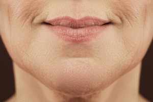 Read more about the article Chin Wrinkles Decoded: Identifying the Causes and Finding Solutions