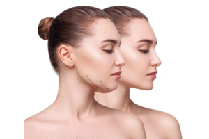 Read more about the article Optimal Chin Rejuvenation: Combining Treatments