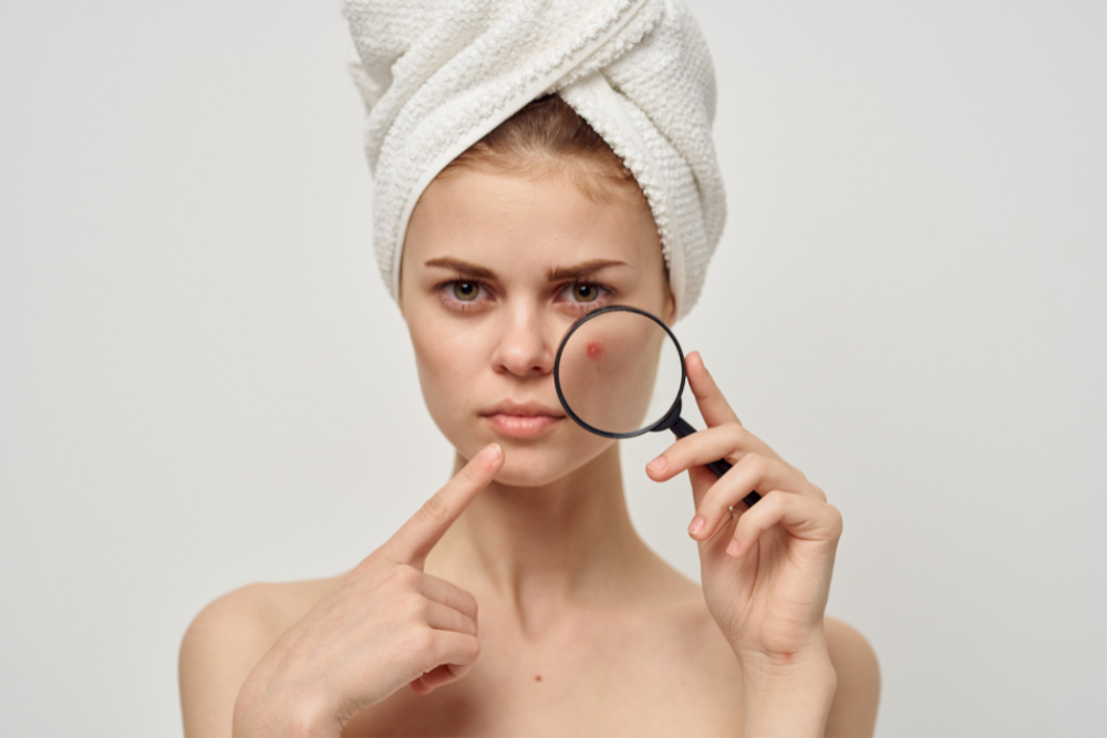 You are currently viewing Summer-Proof Your Botox & Fillers: What You Need to Know