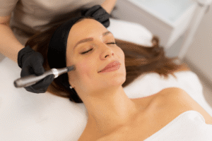 Read more about the article Microneedling for Glow: Brighter, Younger Skin Awaits