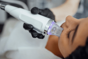 Read more about the article Microneedling After 50: Reverse Aging Signs?