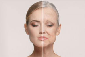Read more about the article Medical Peels: Fine Lines to Acne Scars