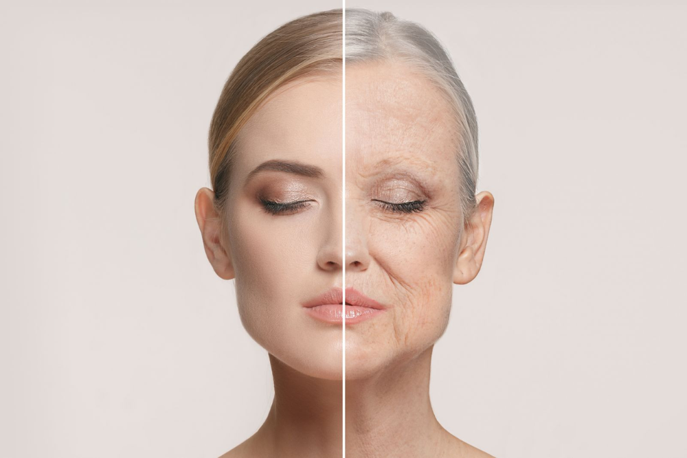 You are currently viewing Medical Peels: Fine Lines to Acne Scars