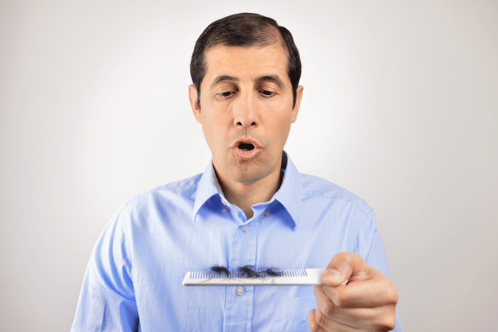 You are currently viewing Decoding Male Hair Loss: Science & Solutions