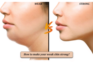 Read more about the article Chin Lifts: A Surgical Approach to Wrinkle Reduction