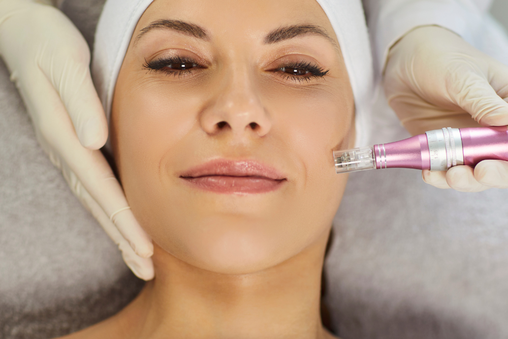 You are currently viewing Finding the Right Microneedling Professional
