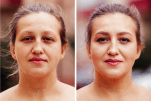 Read more about the article The Mid-Winter Glow: Essential Non-Surgical Refreshers to Combat the Slump