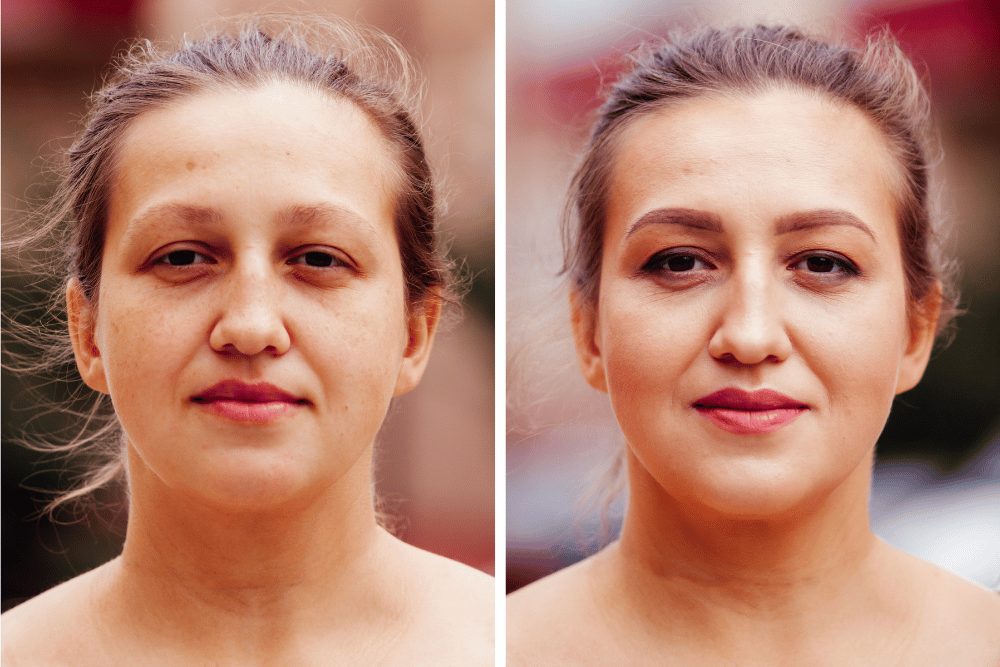 You are currently viewing The Mid-Winter Glow: Essential Non-Surgical Refreshers to Combat the Slump