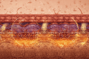 Read more about the article The Deep Freeze: The Best Intensive Treatments to Do Before Spring Break