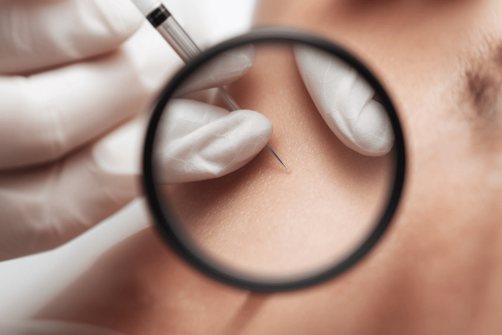 You are currently viewing Filler Horror Stories: What to Avoid and How to Choose a Qualified Provider