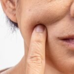 Are You “Filling” Your Wrinkles or Just Stretching Your Aging Skin?