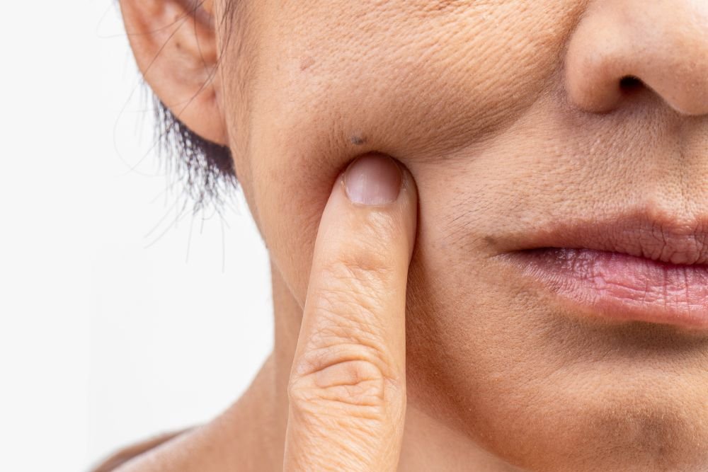 You are currently viewing Are You “Filling” Your Wrinkles or Just Stretching Your Aging Skin?