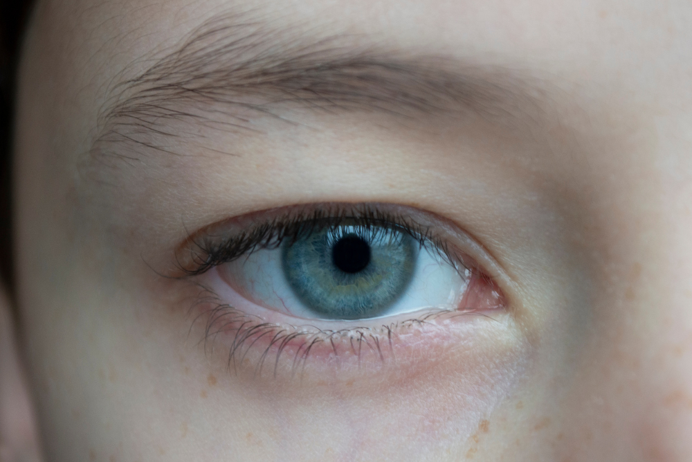 PRF treatment for dark circles and under eye hollowness near Scottsdale AZ