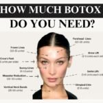 The Unit Debate: How Much Botox Do I Actually Need?