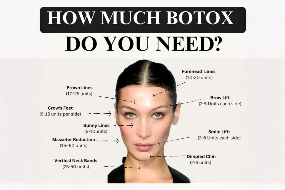 You are currently viewing The Unit Debate: How Much Botox Do I Actually Need?