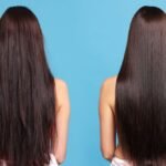 The “Dormant Follicle” Theory: Can PRF Actually Regrow Hair?