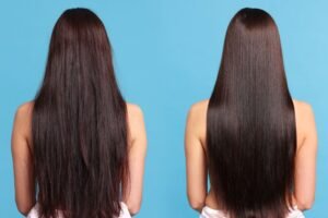 Read more about the article The “Dormant Follicle” Theory: Can PRF Actually Regrow Hair?