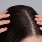 Scalp Longevity: Why PRF is the “Bio-Hacker’s” Secret to Ageless Hair