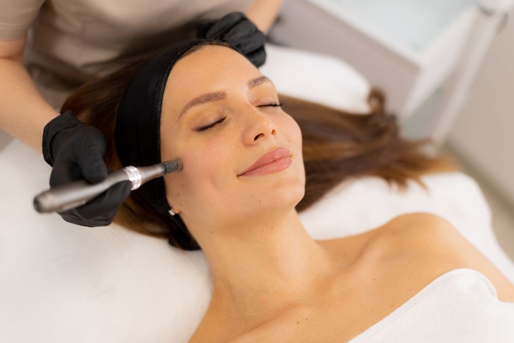 You are currently viewing Microneedling: What Happens Beneath the Skin Surface?