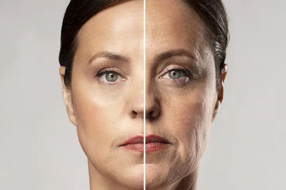 You are currently viewing The Non-Surgical Face Lift: Mechanical Pull vs. Biological Regeneration