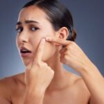 The Acne Brain: The Frustrating Science of the “Big Event” Breakout
