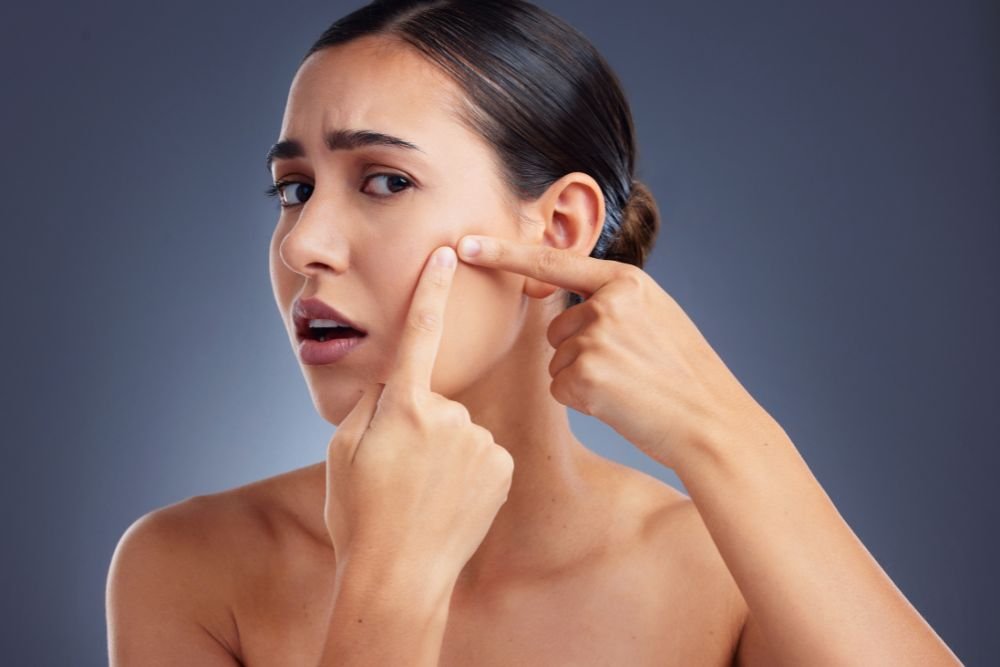 You are currently viewing The Acne Brain: The Frustrating Science of the “Big Event” Breakout