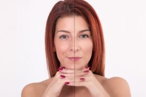 Read more about the article The Collagen Horizon: Mapping the Real Structural Results of Your CO2 Laser