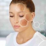 The Silent Pigment Wave: The Biology of Post-Inflammatory Hyperpigmentation (PIH)