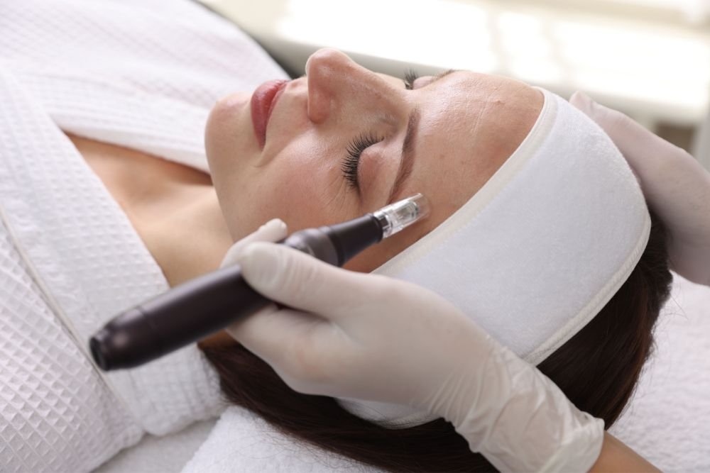 You are currently viewing The Cleopatra Connection and Electric Current: Surprising Microneedling Trivia