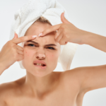 Under Pressure: How Popping Pimples Destroys Dermal Collagen Architecture