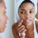 Sabotaging Your Skin: 5 Skincare Habits That Secretly Drive Breakouts