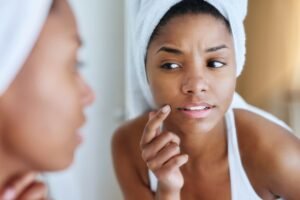 Read more about the article Sabotaging Your Skin: 5 Skincare Habits That Secretly Drive Breakouts